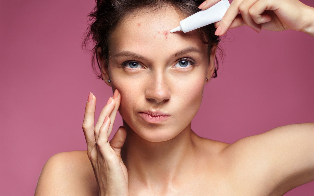 How To Remove Blackheads Without Damaging Your Skin