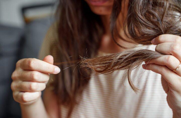 5 Things To Do When You Experience Hair Loss